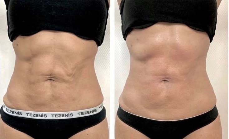 Ventre & abdomen